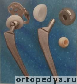 Эндопротезирование крупных суставов Эндопротезирование крупных суставов